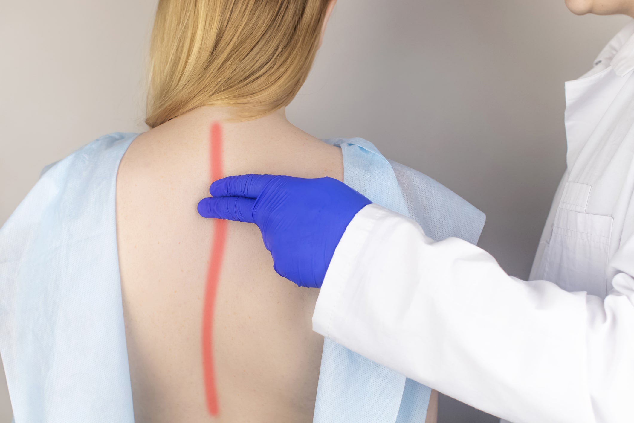 Lordoză lombară la adulți – diagnostic și tratament