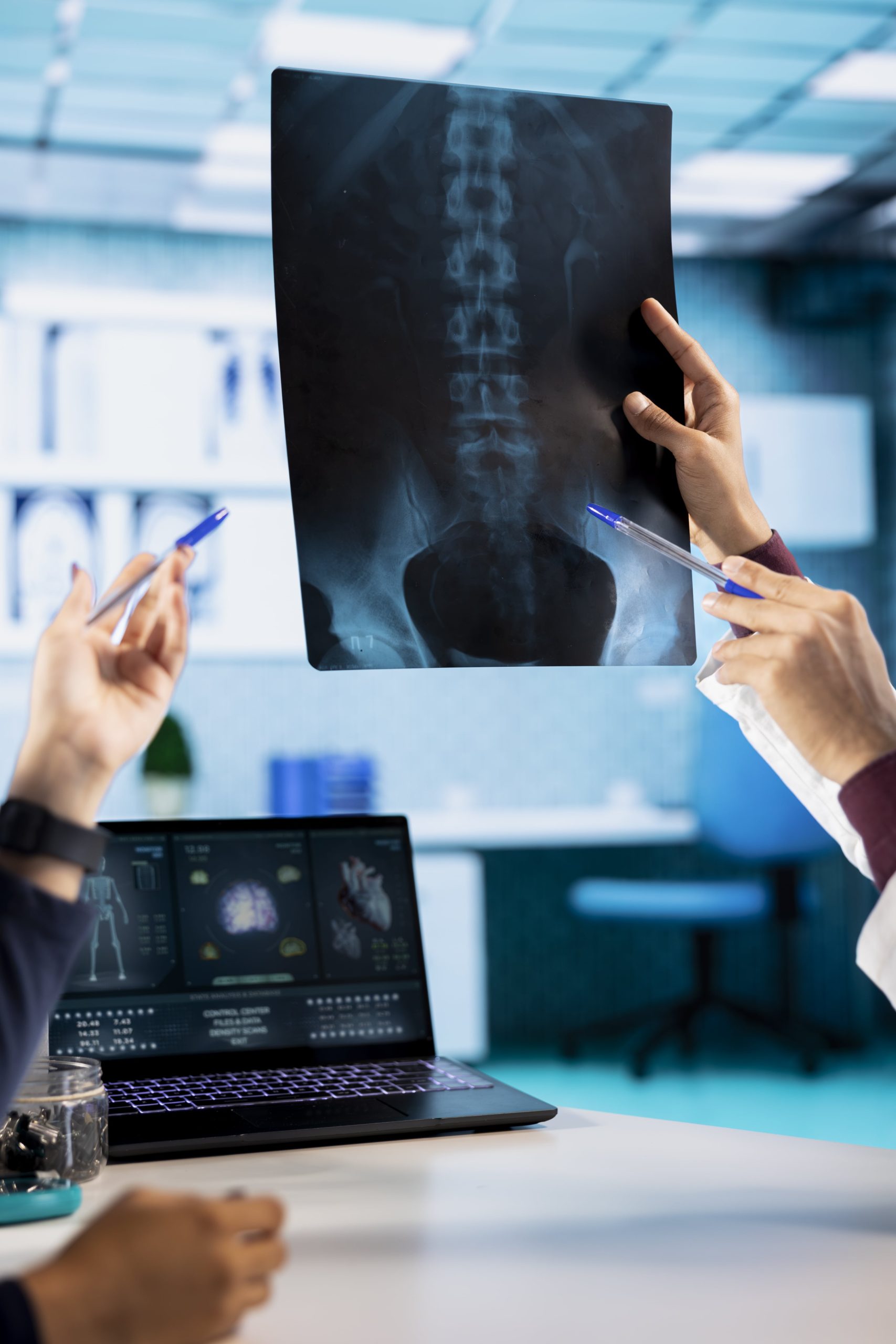 RMN pentru diagnosticarea sacroileitei la nivelul articulației sacroiliace